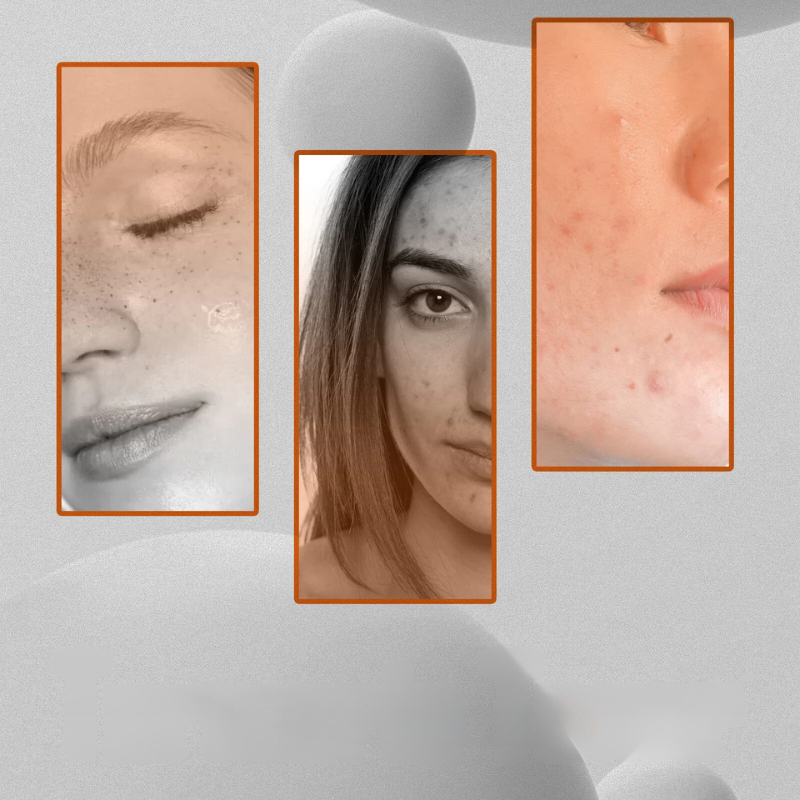 Spotloser Glühtoner - Dunkler Spot -Korrektor und Aufhellen der Gesichtspflege-3