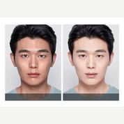 Revitamen Toner - Ölkontrolle und Flüssigkeitszufuhr für die Haut von Männern-3