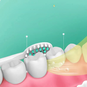 Cleanflex - Nicht -re -theargable klanges Zahnbürste für ein frisches Lächeln-5