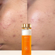 Collagenglow feste Essenz-Hauterneuerung und Anti-Aging-Ton-4