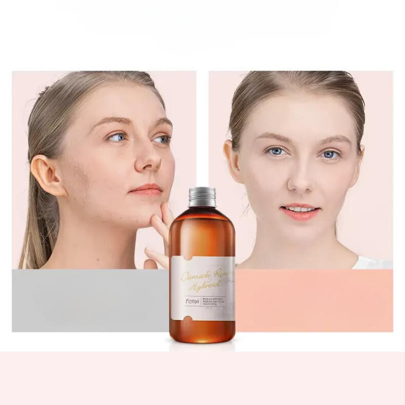 Rosehydra Nebel - nahrhafte Rosenwassertoner für trockene Hautpflege-2