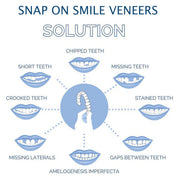 Lächeln Furnier (obere und untere enthaltene) 5