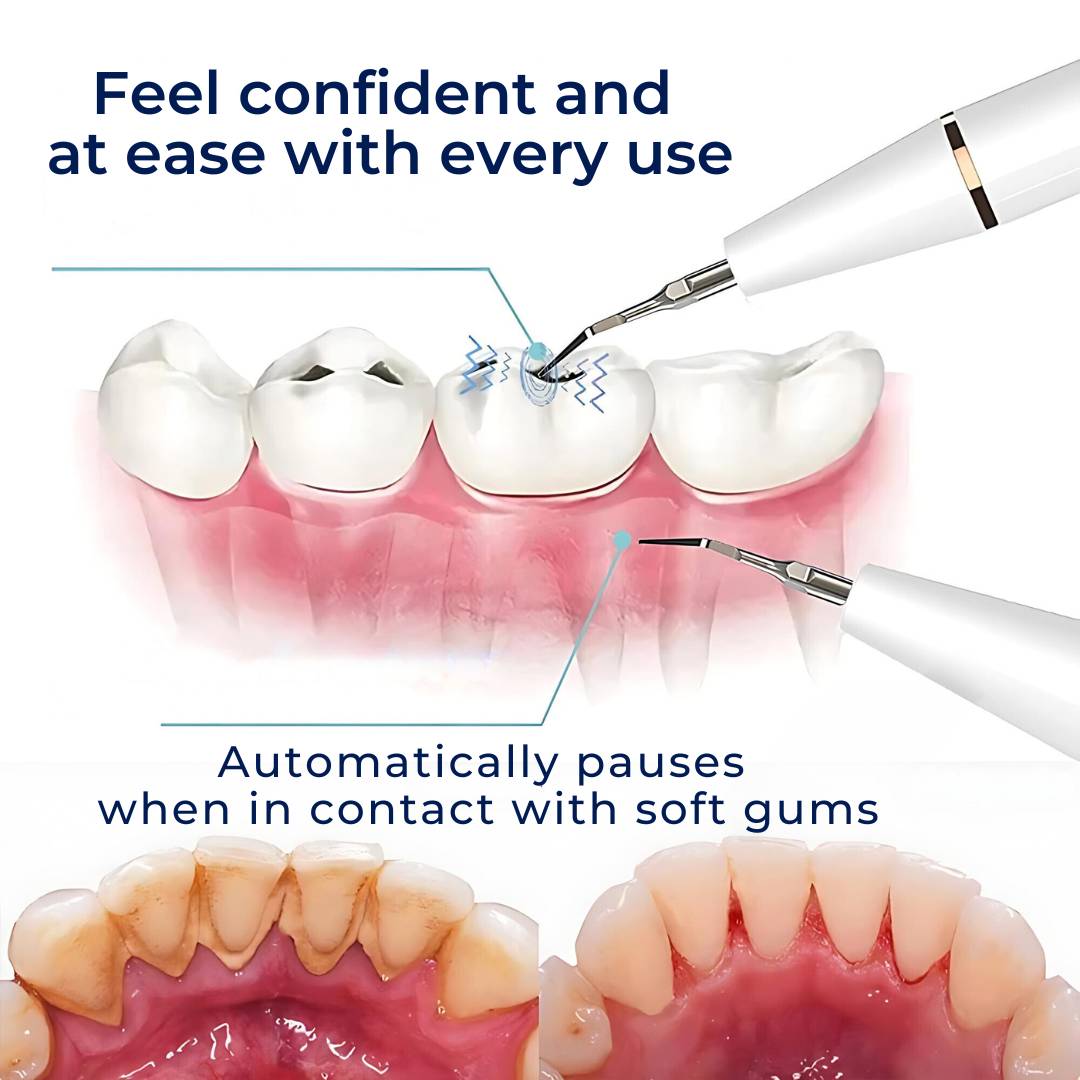 Plaquefree Plaque Remover für Zähne | Ultraschallzählerreiniger - Tartarentferner von zu Hause - Tiefenzähne Reinigung und Politur 6