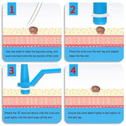 Skin-Tag-Entfernungskit-2-in-1 Silikonbandligationssystem für den sicheren Heimgebrauch-5