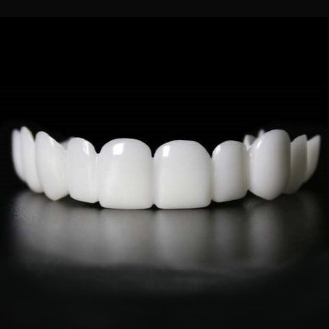 Sofortige Lächelverwandlung mit Snap on Smile Veneers 2