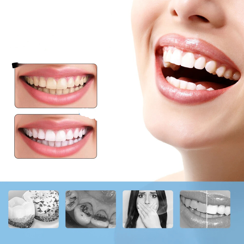 Freshwhite - 6 -Gang -Elektrozähne Whitening & Scaler-2