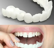 Verstellbare Snap-On-Zahnersatz 2