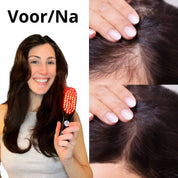 Vermeiden Sie das Ausdünnen von Haaren und Haarausfall verbessert und stärkt die Haarstruktur - Haarglam-4